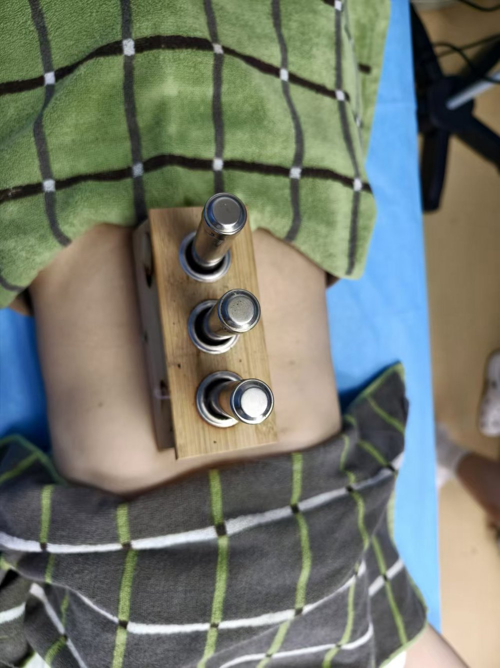 灸中脘神阙气海03